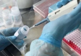 O‘zbekistonda 8 ta xususiy tibbiyot muassasasida koronavirusga test topshirish mumkinligi aytildi фото