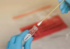 O‘zbekistonda yana 21 kishida koronavirus aniqlandi фото