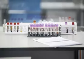 Биолог: коронавирус билан эмланганда организм қариши секинлашади фото