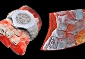 Yangi Zelandiya ota-bola 3D-pentgen ixtiro qilishdi (video) фото
