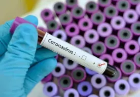 O‘zbekistondagi koronavirus bemorlari haqida yangi ma’lumotlar berildi фото
