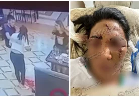 Қашқадарёда йигит ўзи билан танишмаган қизнинг юзига шиша идиш билан урди фото
