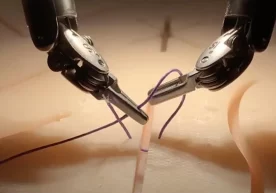 AQSHda jarroh robot videoga qarab operatsiya qilishni o‘rgandi фото
