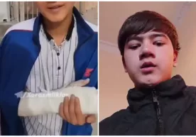 «Пранк» видео учун шифокорларни алдаб соғлом қўлини гипс қилдирган ўсмир узр сўраб чиқди фото
