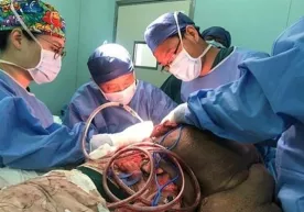 Xitoylik erkakning orqasidagi 15 kg oʻsimtani olib tashlashga bir kundan koʻproq vaqt talab etildi фото