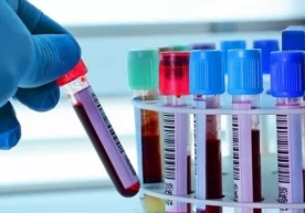 Япон олимлари COVIDнинг оғир кечишини аниқлаш усули ҳақида маълумот беришди фото