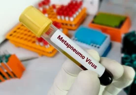 Санэпидқўмита метапневмовирус инфекцияси тўғрисида маълумот берди фото