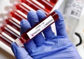 O‘zbekistonda koronavirus bilan kunlik kasallanish holati yana 600 kishidan kamaydi фото