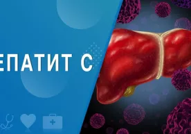 Гепатитнинг «С» тури аниқланган беморлар дори воситалари билан бепул таъминланади фото