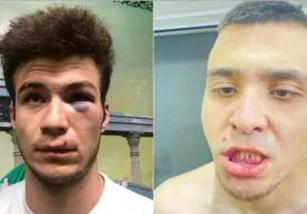 «Surxon» sobiq futbolchilari qay tarzda kaltaklanganini so‘zlab berdi фото