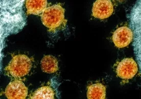 Коронавируснинг осон тарқалишига имконият яратувчи иқлим шароити маълум қилинди фото