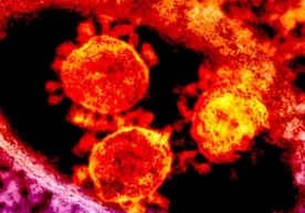 Koronavirus bilan qayta kasallanish sababi aniqlandi фото
