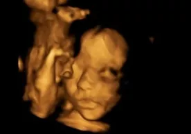 Homila operatsiya tufayli ona qornidan olinib, yana joyiga qaytarib qo‘yildi фото