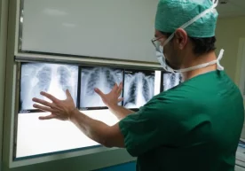 Pulmonolog o‘pka zararlanishining ilk alomatlarini ma’lum qildi фото