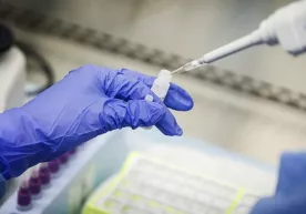 Биолог коронавирусдан ҳимояланиш бўйича «аниқ маслаҳат» берди фото