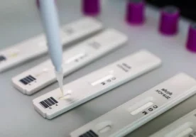 O‘zbekistonda koronavirusga immunitetni aniqlash testlari o‘tkazilishi boshlandi фото