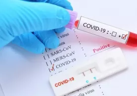 O‘zbekistonda o‘tgan bir sutka ichida 297 kishida pnevmoniya, 458 kishida koronavirus tasdiqlandi фото