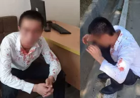 Учтепада ўқитувчи ўқувчисининг яқинлари томонидан калтакланди фото