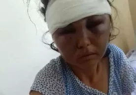 "Мени ҳатто онам танимади": Булунғурда 10 кунлик келинчакни эри аёвсиз калтаклади фото