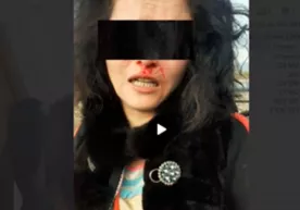 Сурхондарёда 32 ёшли аёл бошқа аёллар томонидан «самосуд» қилинган фото