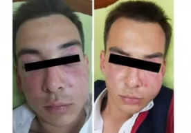 Тошкентда мактаб ўқувчиси покистонлик ўз мактабдошини аёвсиз дўппослади фото