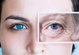 Göz altı kırışıklıkları nasıl giderilir? фото