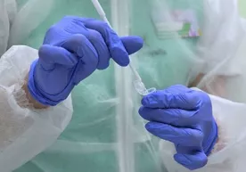 Коронавирус ўпкадан бошқа аъзоларни ҳам жароҳатлаши мумкин фото