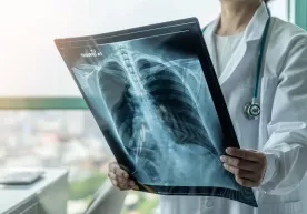 Shifokor chekishdan voz kechishning katta foydasini aytdi фото
