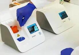 Bakterial va virusli infeksiyani bir-biridan farqlovchi tezkor test ishlab chiqildi фото
