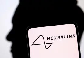 Miyasiga Neuralink chipi o‘rnatilgan birinchi odam fikr kuchi bilan tvit yozdi фото