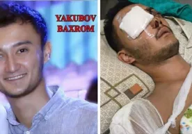 Аттракциондан йиқилиб жароҳат олган актёрга 98 млн. сўм моддий зарар ундириб берилди фото