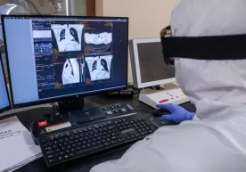 Rossiyalik virusolog koronavirus bilan qayta kasallanish muddatini baholadi фото