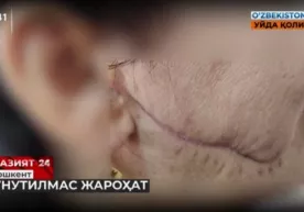 Тошкентда хотинининг юзини лезвия билан кесган эркакка қамоқ жазоси тайинланди фото