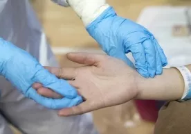 Франциялик шифокорлар коронавируснинг янги белгиларини маълум қилди фото