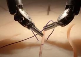 AQSHda jarroh robot videoga qarab operatsiya qilishni o‘rgandi фото