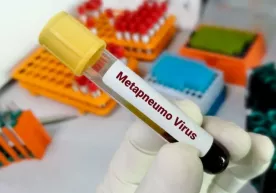 В санэпидкомитете сообщили о метапневмовирусной инфекции фото