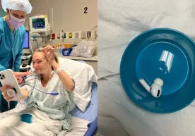 Amerikalik ayol tasodifan AirPods Pro‘ni yutib yubordi фото