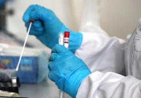 O‘zbekistonda o‘tgan bir sutka ichida yana 303 kishida koronavirus tasdiqlandi фото
