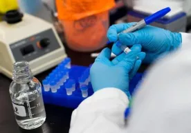 Yevropada koronavirusni laboratoriya sharoitida yenga olgan antitana yaratildi фото