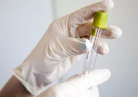 Janubiy Amerikada noma’lum xavfli virus aniqlandi фото