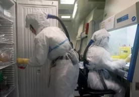 Олимлар коронавирус терида қанча вақт яшашини аниқлади фото