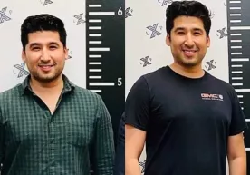 Amerikalik erkak 75 ming dollar evaziga oyoqlarini uzaytirdi фото