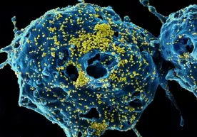 Koronavirus: o‘lim holatining asosiy omillari фото
