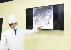 Ўзбекистонга коронавирусни катталаштириб кўрсатадиган электрон микроскоп олиб келинди фото