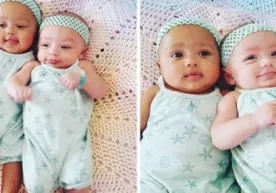 Tanasi rangi turli egizak opa-singillar ijtimoiy tarmoqlarni zabt etdi фото