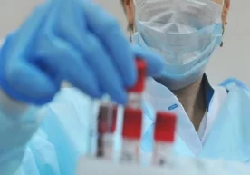 Коронавирус инфекцияси аниқланган беморларнинг аҳволи тўғрисида маълумот берилди фото