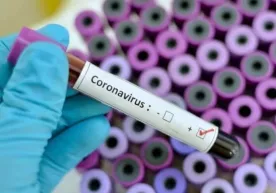 Жаҳонда коронавирусга чалинганлар сони 1 миллиондан ошди фото