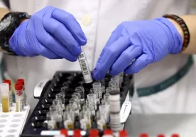 Koronavirus va pnevmoniya: Kunlik holatlar soni 1200dan ortiq, yana 6 bemor vafot etdi фото