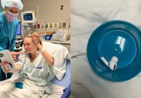 Америкалик аёл тасодифан AirPods Pro’ни ютиб юборди фото