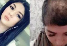 Toshkentlik qiz «Telegram» dagi yozishma sabab erkakning xotini tomonidan ayovsiz kaltaklandi фото